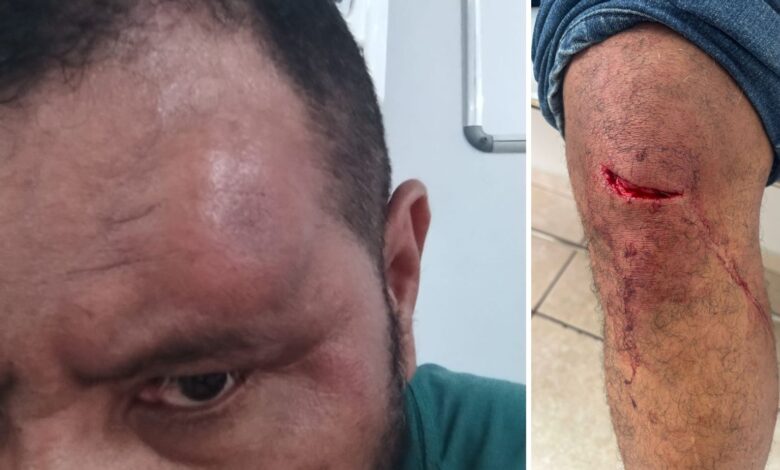 Ferimentos do oficial agredido em Hortolândia